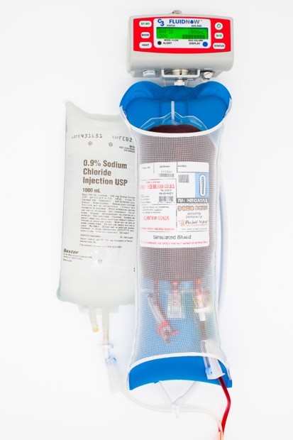 FluidNow attached to a 1000 mL 0.9% Sodium Chloride IV bag